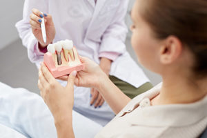 dental implants services 