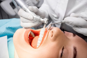 teeth cleaning katy tx