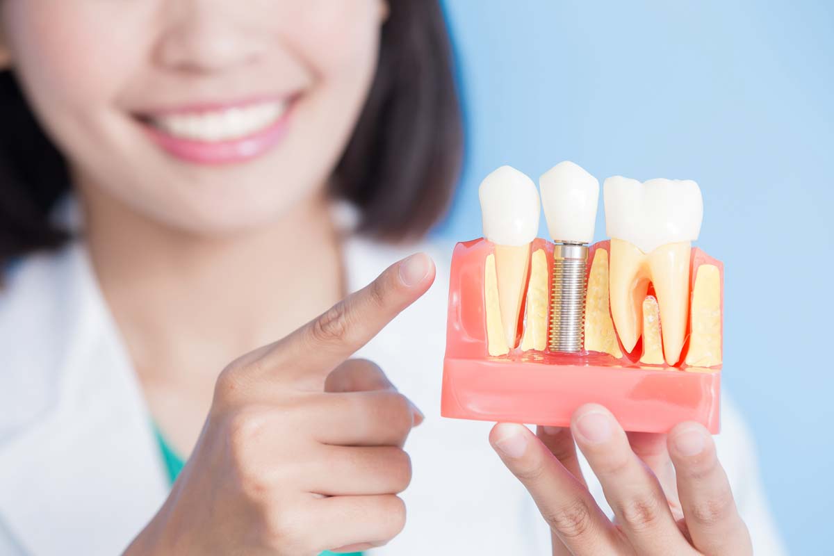 dental-implants (4) woman with model of dental implants