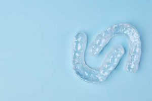 example of clear aligners